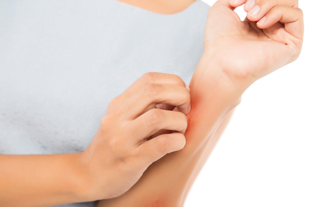 Got A Brass Allergy? Check Out 4 Solutions Here To Save The Day