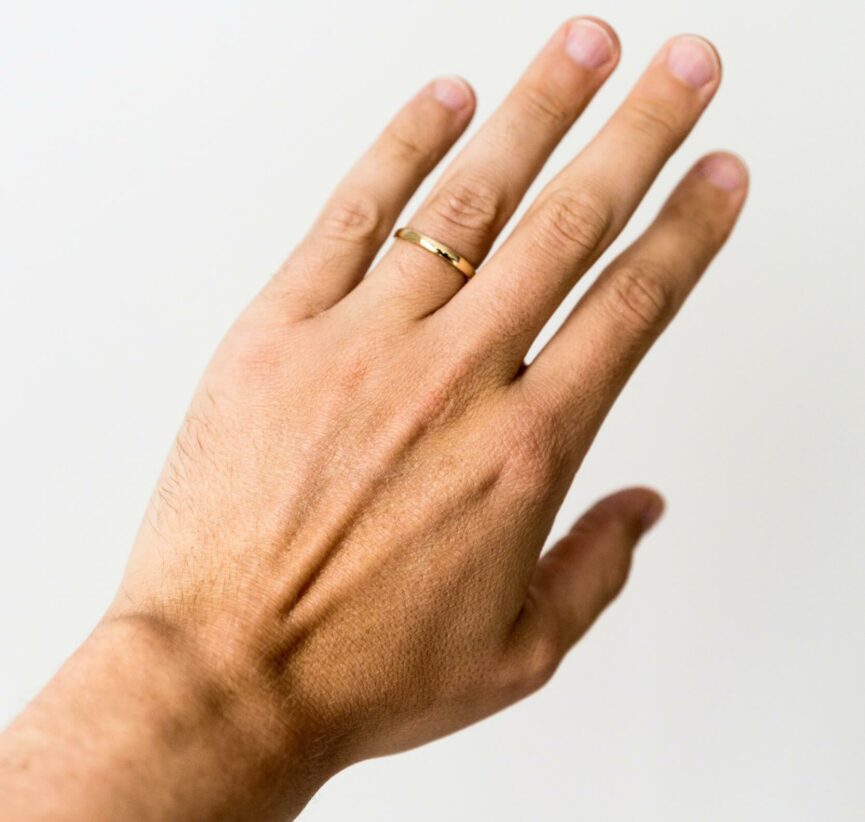 ring for arthritis